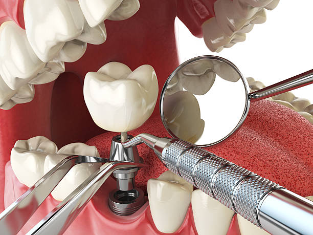 Best Emergency Broken Tooth Repair in Cutchogue, NY