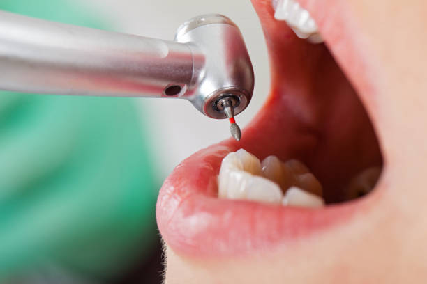 Best Emergency Treatment for Toothache in Cutchogue, NY